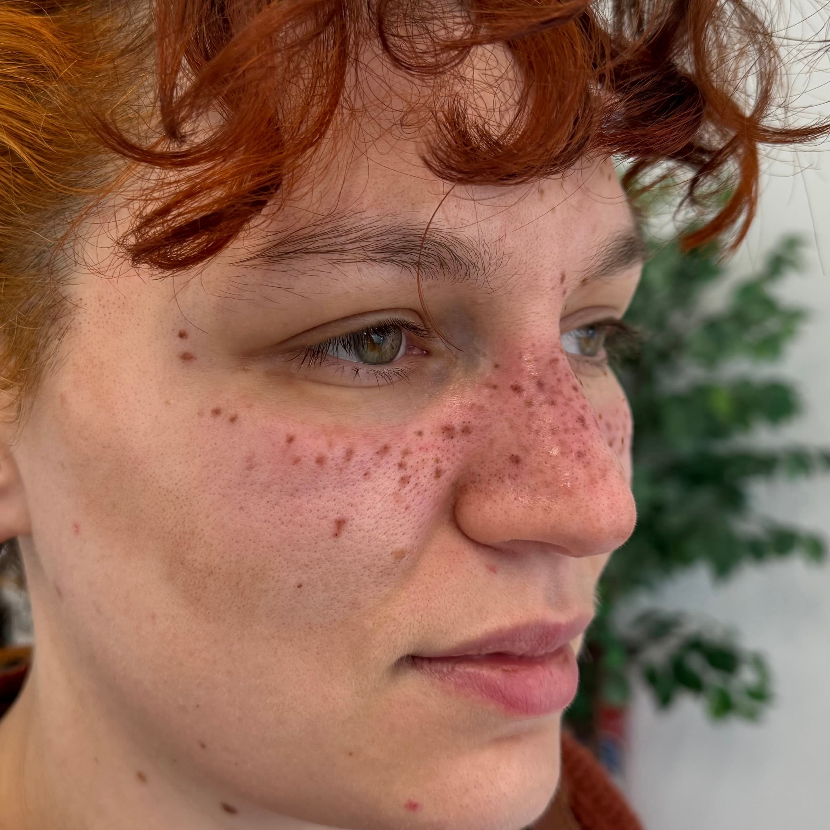 Tatouage permanent de taches de rousseur avec finition réaliste, maquillage semi-permanent par Habiba Med à Dijon.