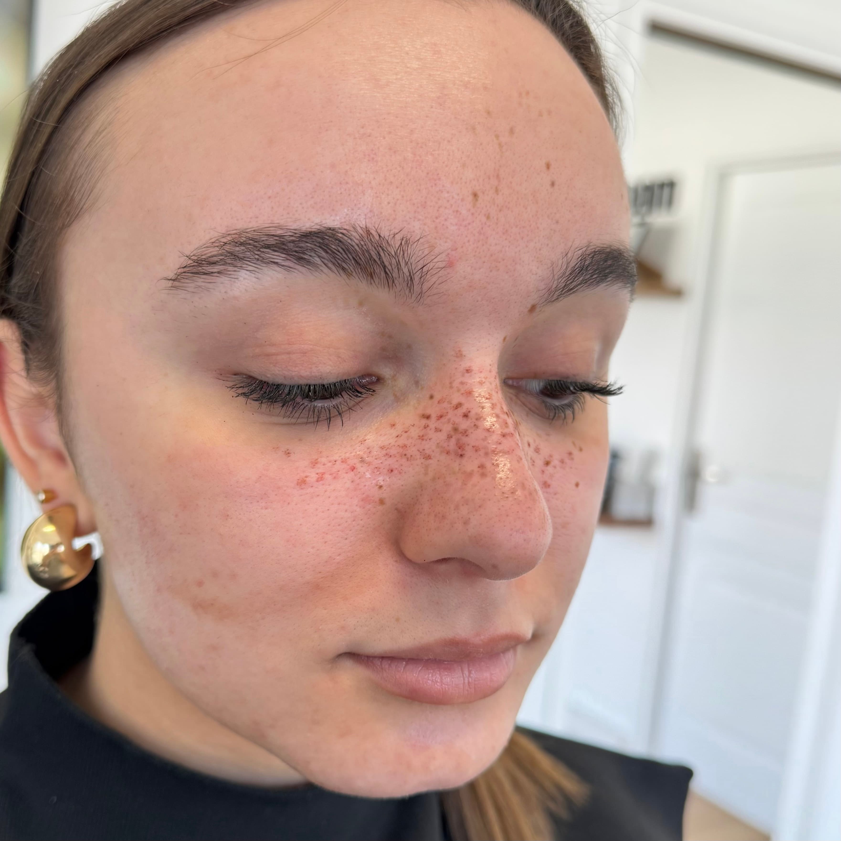 Tatouage cosmétique de fausses taches de rousseur réalisé à Dijon par Habiba Med, maquillage semi-permanent naturel.