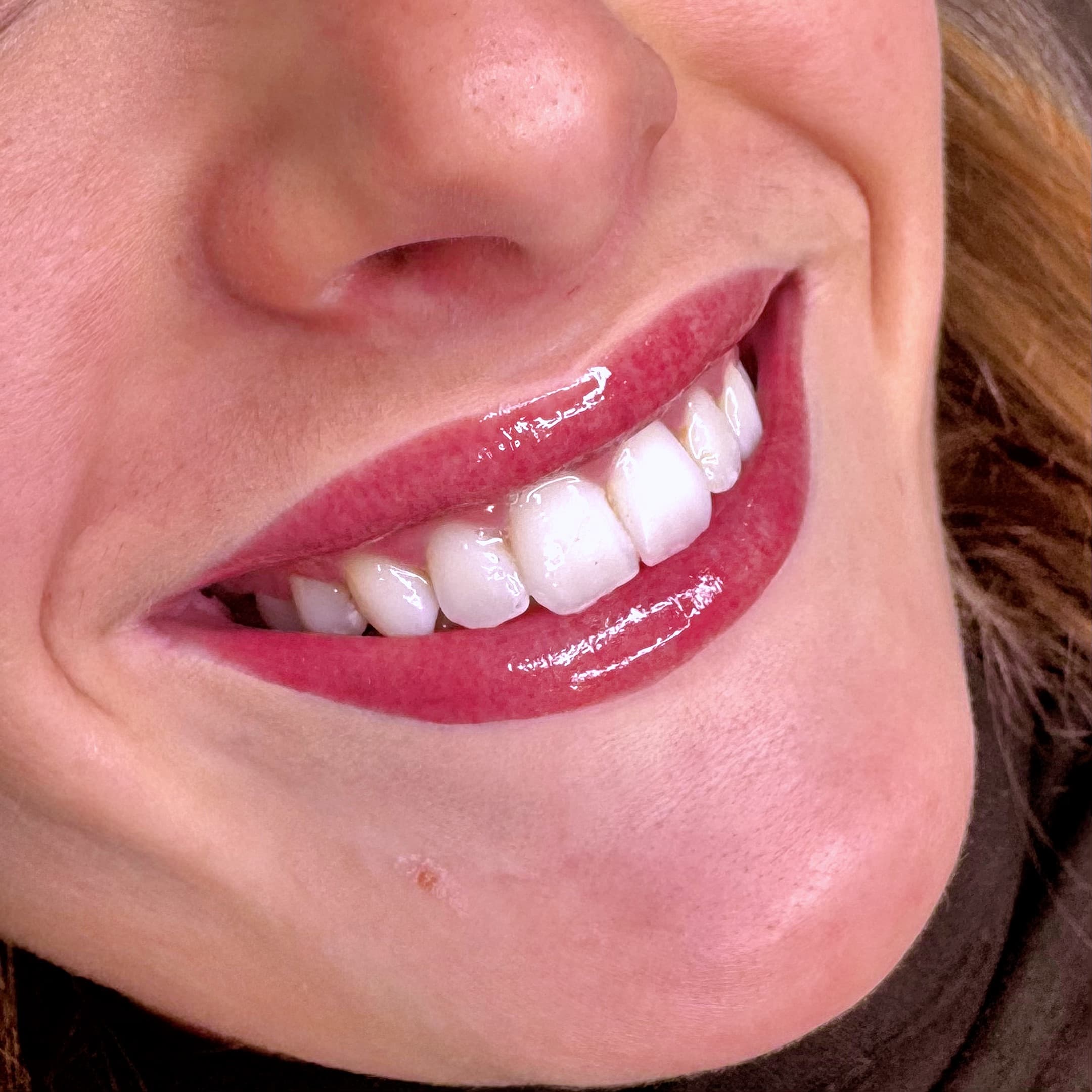 Lèvres tatouées avec un effet Candy Lips à Dijon, pigmentation précise et uniforme.